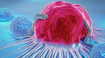 causesofcancer